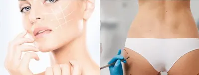 DERMEDICA DERMATOLOG WENEROLOG POZNAŃ - DR HANNA WALKOWIAK-WRONKA MEDYCYNA ESTETYCZNA